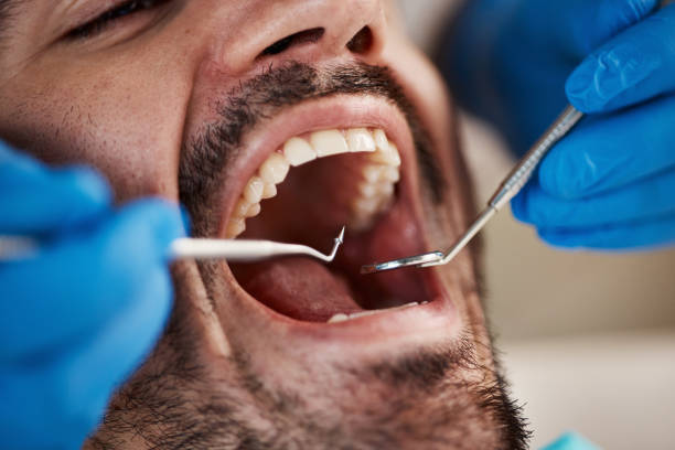 Best Cosmetic Emergency Dentistry in Roseville, OH